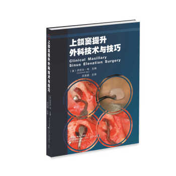 上頜竇提升外科技術與技巧 pdf epub mobi 電子書 下載