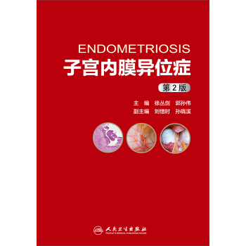 子宮內膜異位癥（第2版） pdf epub mobi 下载