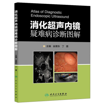 消化超声内镜疑难病诊断图解