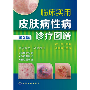 臨床實用皮膚病性病診療圖譜（第2版） pdf epub mobi 下载
