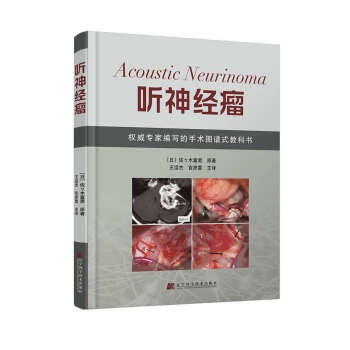 听神经瘤 pdf epub mobi 下载