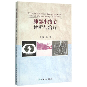 肺部小結節診斷與治療 pdf epub mobi 下载