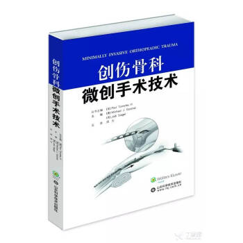 創傷骨科微創手術技術 pdf epub mobi 下载