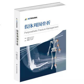 假體周圍骨摺 pdf epub mobi 下载