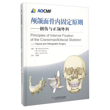 颅颌面骨内固定原则 创伤与正颌外科 [Principles of Internal Fixation of the Craniomaxillofacial Skeleton：Trauma and Orthognathic Surgery] pdf epub mobi 下载