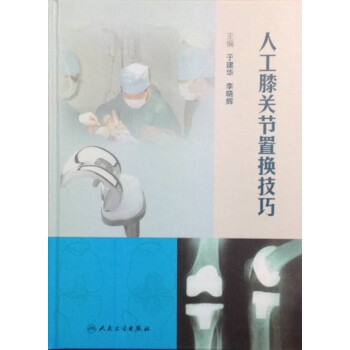 人工膝關節置換技巧 pdf epub mobi 電子書 下載