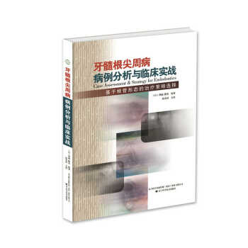 牙髓根尖周病病例分析与临床实战：基于根管形态的治疗疾病策略选择 pdf epub mobi 下载