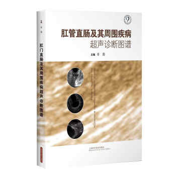 肛管直腸及其周圍疾病超聲診斷圖譜 [Atlas of Ultrasound Diagonsis in Anorectal and Perirectal Diseases] pdf epub mobi 下载