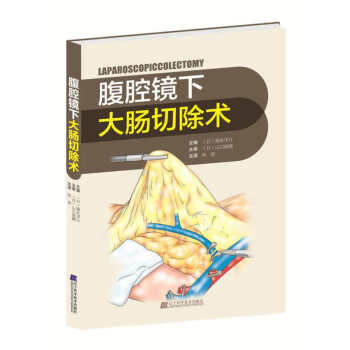 腹腔镜下大肠切除术