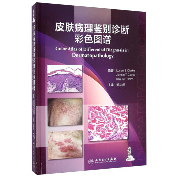 皮膚病理鑒彆診斷彩色圖譜（翻譯版） [Color Atlas Of Differential Diagnosis In Dermatopathology] pdf epub mobi 下载