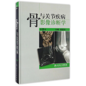 骨與關節疾病影像診斷學（第2版） pdf epub mobi 下载