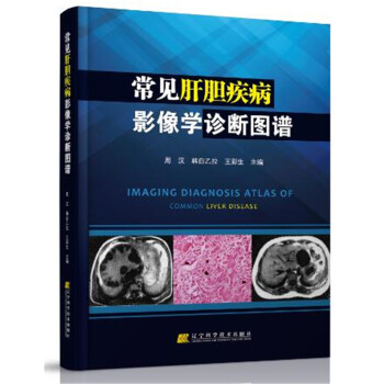 常見肝膽疾病影像學診斷圖譜 pdf epub mobi 下载