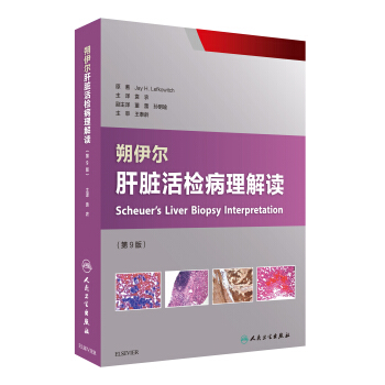 朔伊爾肝髒活檢病理解讀（翻譯版 第9版） [Scheuer's Liver Biopsy Interpretation] pdf epub mobi 下载