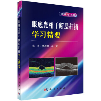 眼底光相干断层扫描学习精要--眼科入门系列 pdf epub mobi 下载