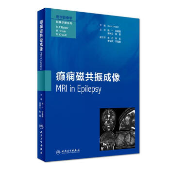 癲癇磁共振成像(翻譯版) pdf epub mobi 下载