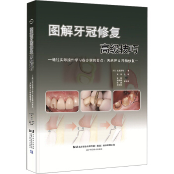 图解牙冠修复高级技巧 pdf epub mobi 下载