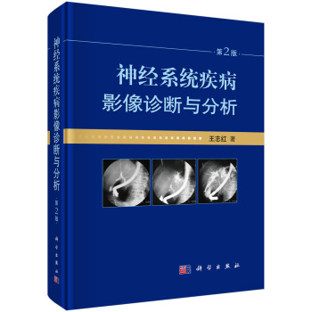 神經係統疾病影像診斷與分析 pdf epub mobi 下载