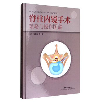 脊柱内镜手术策略与操作图谱 [Atlas of Endoscopic Spine Surgery] pdf epub mobi 下载