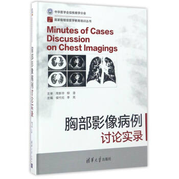 國傢級繼續醫學教育培訓叢書：胸部影像病例討論實錄 [Minutes of Cases Discussion on Chest Imagings] pdf epub mobi 下载