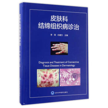 皮膚科結締組織病診治