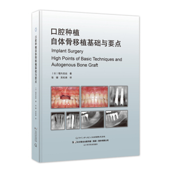 口腔种植自体骨移植基础与要点 pdf epub mobi 下载