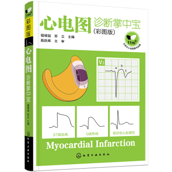 心电图诊断掌中宝（彩图版） pdf epub mobi 下载