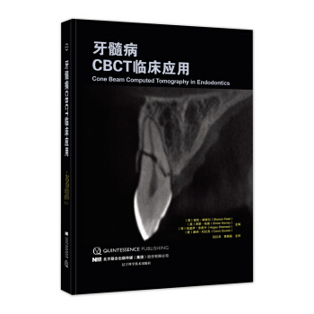 牙髓病CBCT临床应用 pdf epub mobi 下载