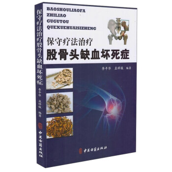保守方法治療股骨頭缺血壞死證 pdf epub mobi 下载