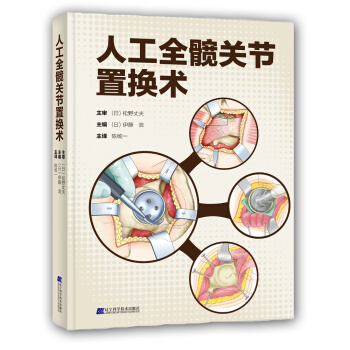 人工全髖關節置換術 pdf epub mobi 下载