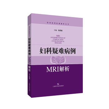 婦科疑難病例MRI解析 pdf epub mobi 下载