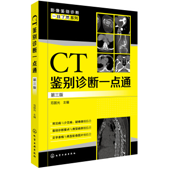 影像鑒彆診斷一目瞭然係列--CT鑒彆診斷一點通（第三版） pdf epub mobi 下载