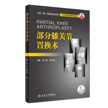 部分膝关节置换术（配增值） pdf epub mobi 下载