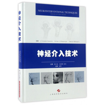 神經介入技術(精) pdf epub mobi 電子書 下載