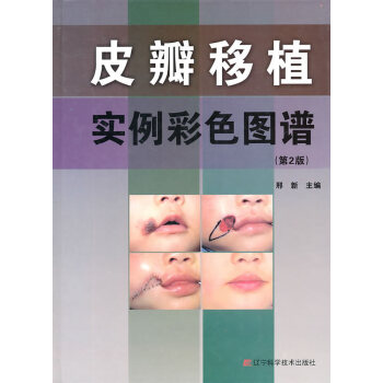 京東圖書 正版認證 皮瓣移植實例彩色圖譜(第2版) pdf epub mobi 電子書 下載