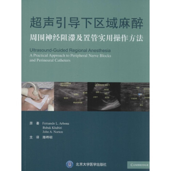 超聲引導下區域麻醉