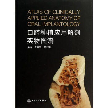 口腔種植應用解剖實物圖譜 pdf epub mobi 下载