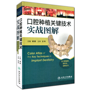 口腔种植关键技术实战图解（供口腔医师、研究生、进修生用） pdf epub mobi 电子书 下载