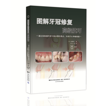 圖解牙冠修復技巧--通過實際操作學習各步驟的要點:天然牙或種植牙(日)土屋賢司著 pdf epub mobi 電子書 下載