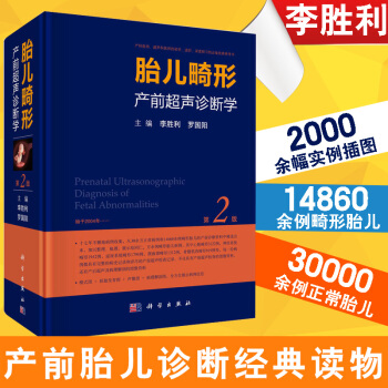 【産科超聲檢查概論】胎兒畸形産前超聲診斷學（第2版）李勝利，羅國陽 産前胎兒診斷 超聲醫 pdf epub mobi 下载