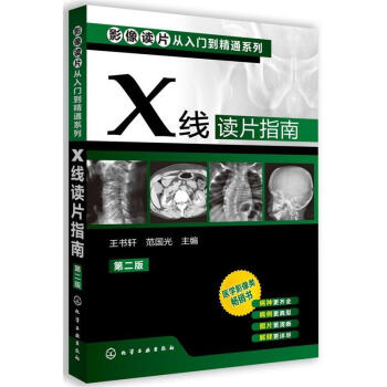 X线读片指南(第二版) 影像学医学类 影像解剖学诊断图谱 影像读片从入门到精通X线读片指南 pdf epub mobi 下载