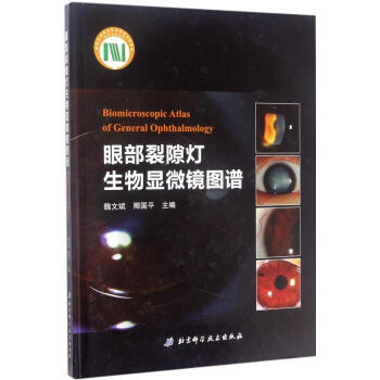 眼部裂隙灯生物显微镜图谱 pdf epub mobi 下载