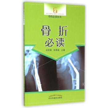 骨折必读 pdf epub mobi 下载