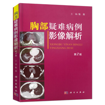 胸部疑難病例影像解析 第2版 張嵩 pdf epub mobi 下载