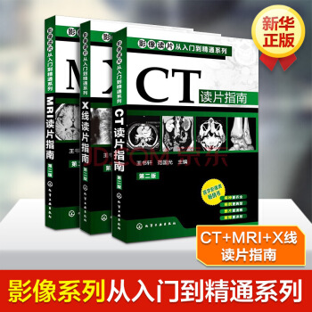 影像读片从入门到精通系列(第二版) --CT读片指南+MRI读片指南+X线读片指(第2版) pdf epub mobi 下载