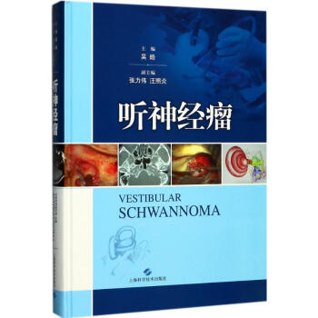聽神經瘤