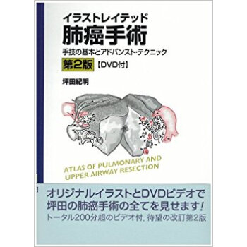 イラストレイテッド肺癌手術 手技の基本とアドバンスト?テクニック pdf epub mobi 下载