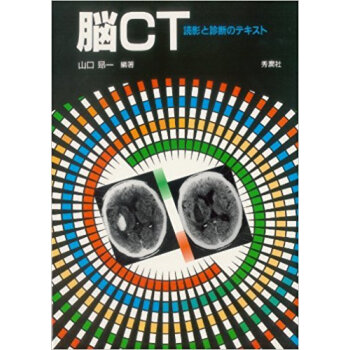 脳ct 読影と診断のテキスト