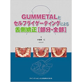 Gummetalとセルフライゲーティングによる舌側矯正〈部分?全部〉 pdf epub mobi 电子书 下载