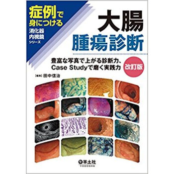 大腸腫瘍診斷 豊富な寫真で上がる診斷力、Case Studyで磨く実踐力 pdf epub mobi 電子書 下載