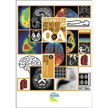 ここが知りたい認知症の画像診断q&A pdf epub mobi 下载